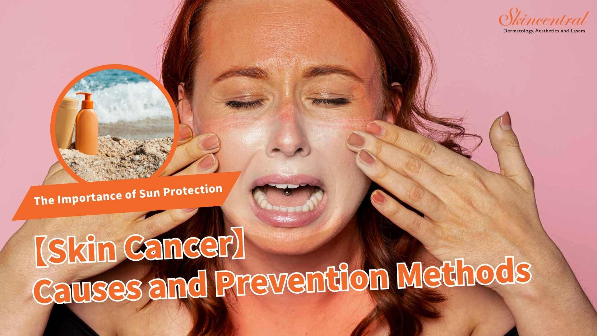 skin cancer cause and prevention methods